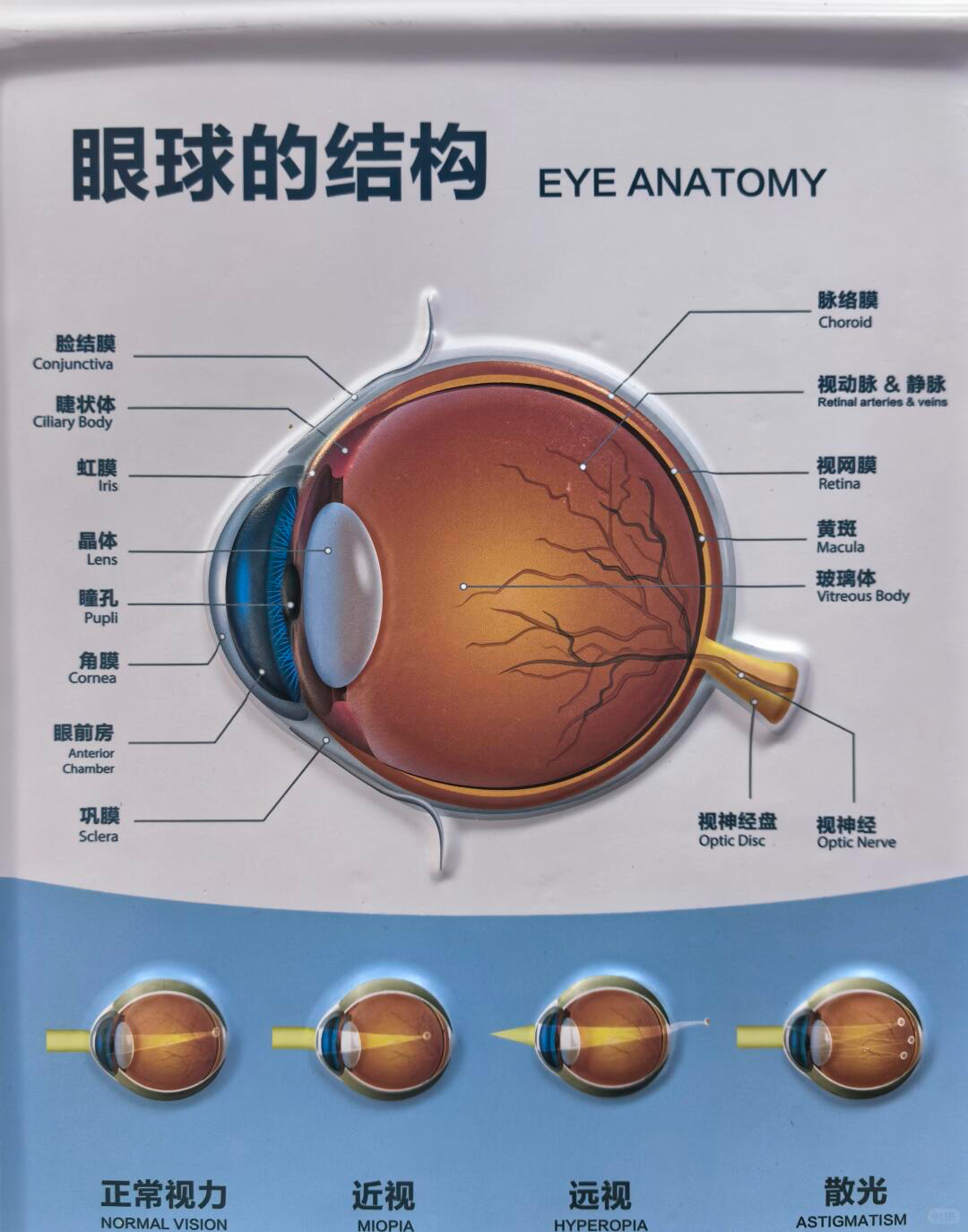 黄斑不是眼病，你了解了吗？出现这些症状才要警惕 