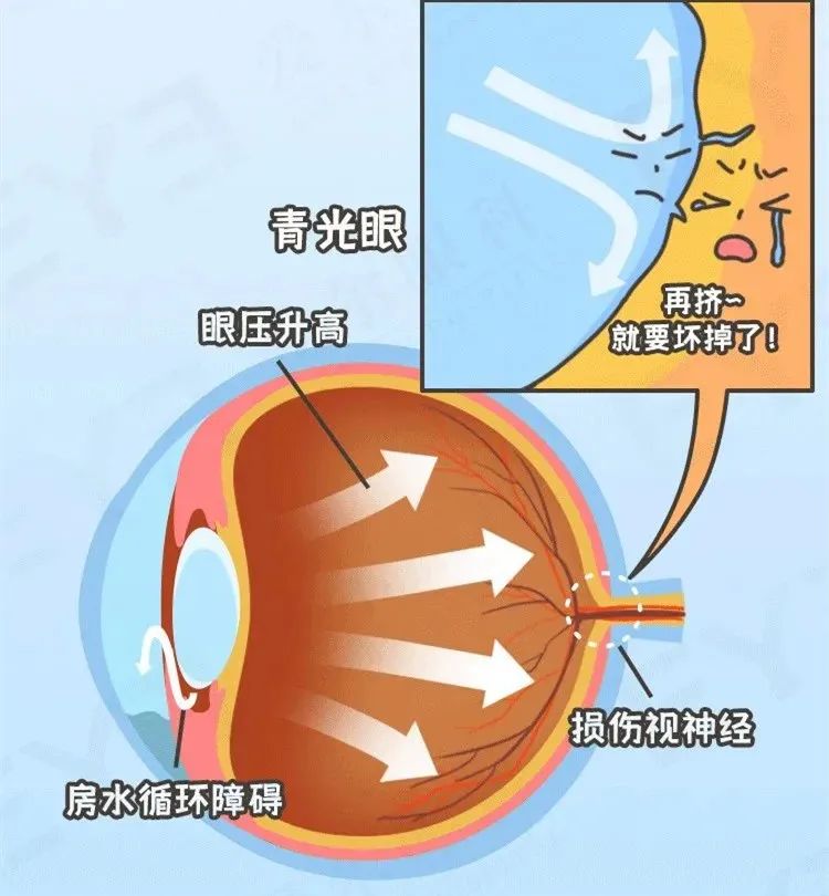 注意！头疼，找不到原因！？可能是它......