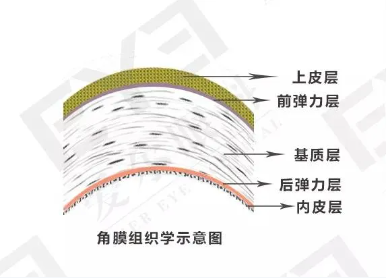 角膜厚度：激光近视手术的入场券