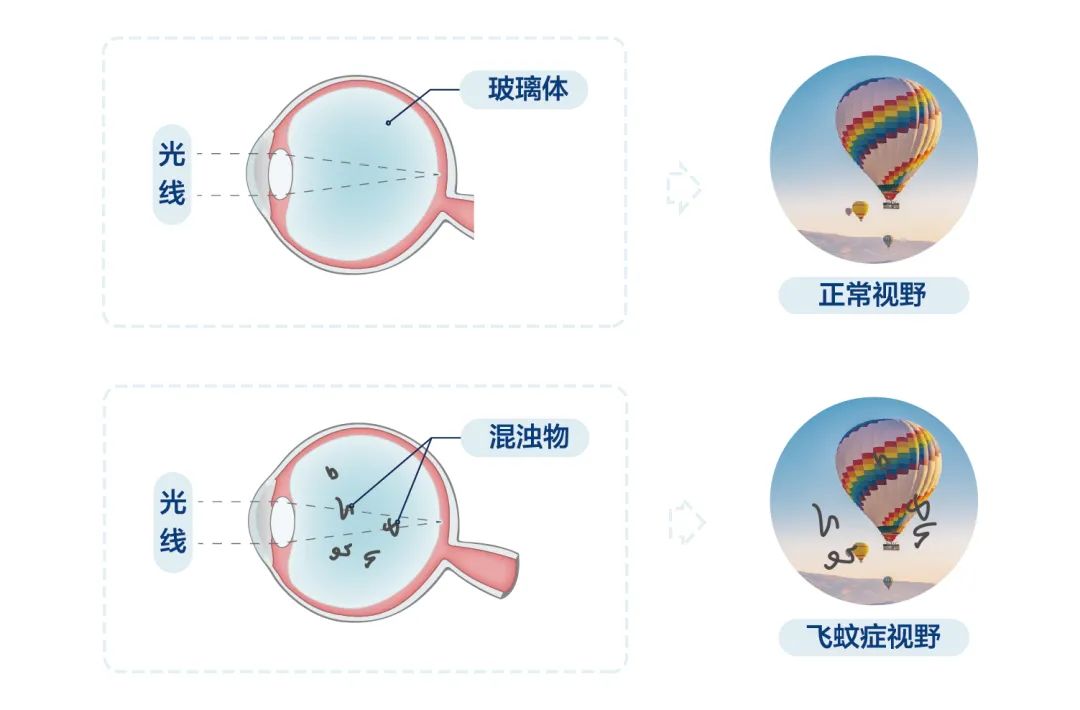 飞蚊.jpg