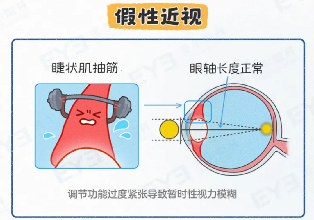 孩子近视50度，要马上配眼镜吗？