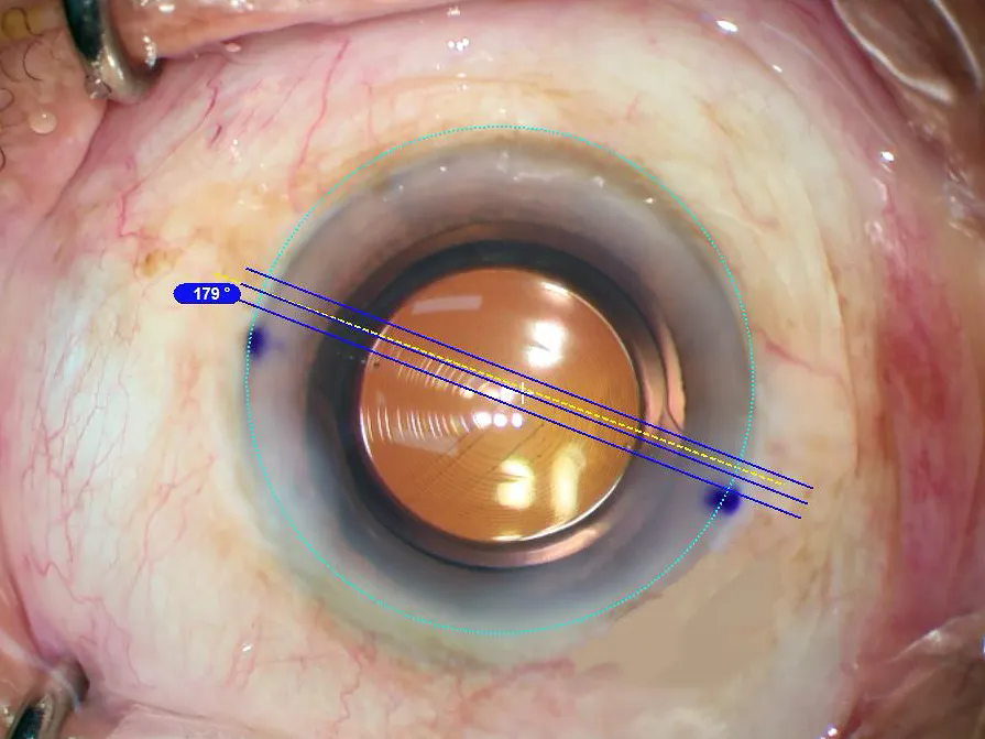 640_wx_fmt=png&from=appmsg&tp=webp&wxfrom=5&wx_lazy=1.webp (3).png