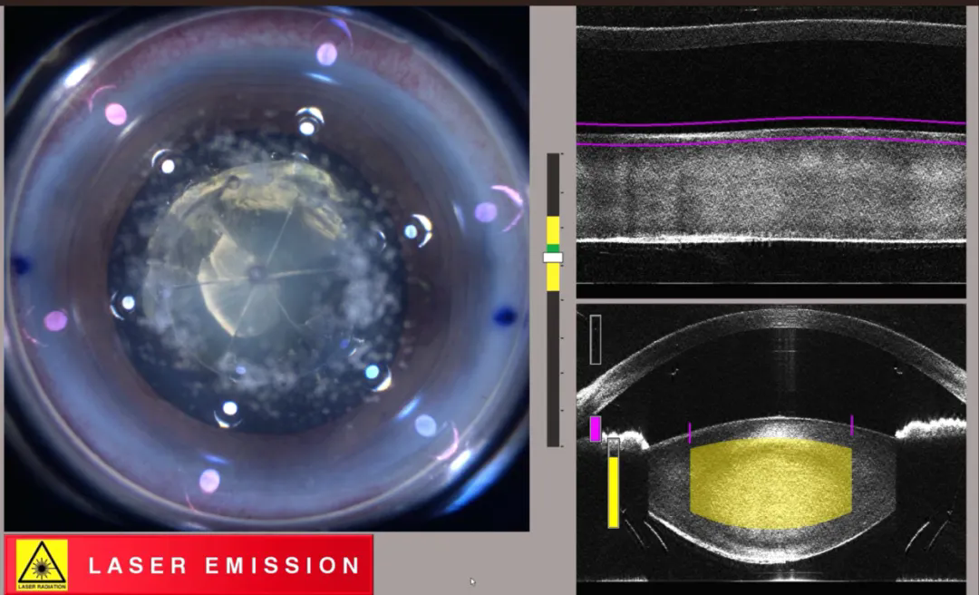 640_wx_fmt=png&from=appmsg&tp=webp&wxfrom=5&wx_lazy=1.webp (1).png