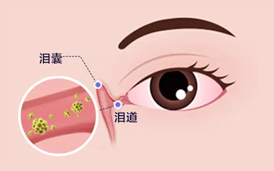 640_wx_fmt=jpeg&from=appmsg&tp=webp&wxfrom=5&wx_lazy=1.webp (8).png