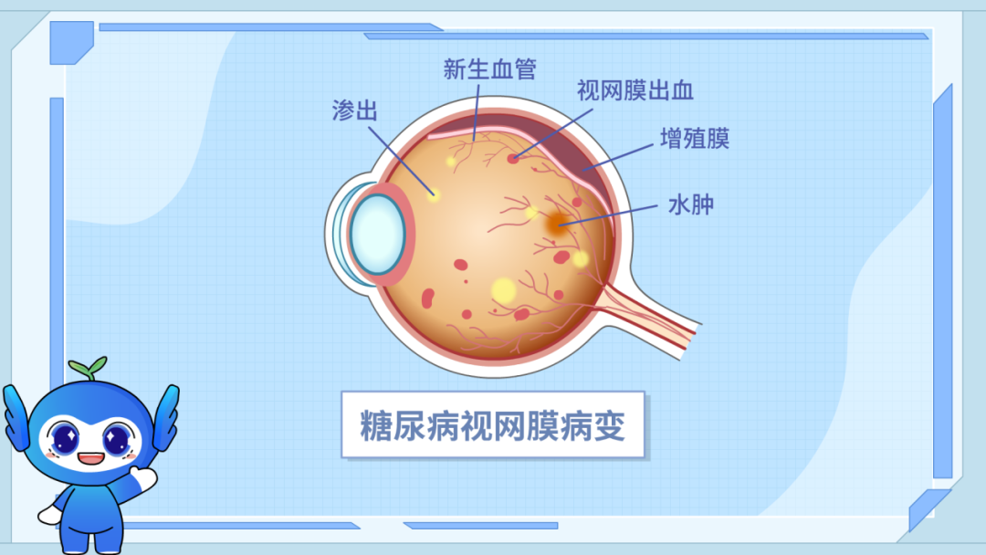 眼底1.png