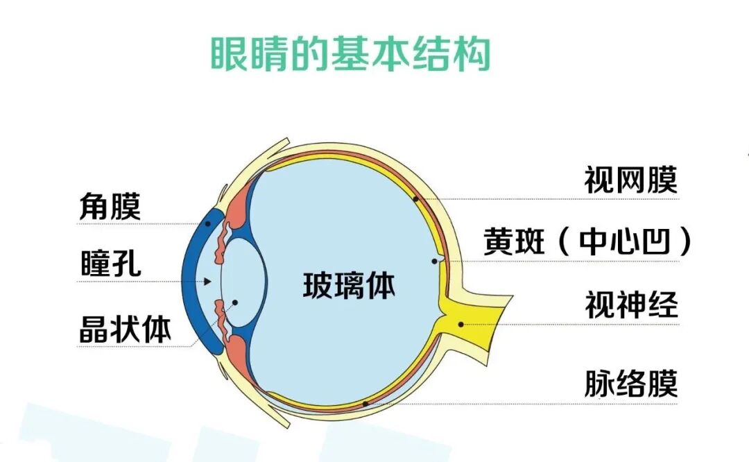 飞蚊症3.jpg