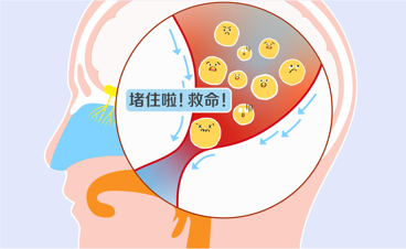 泪道1.png