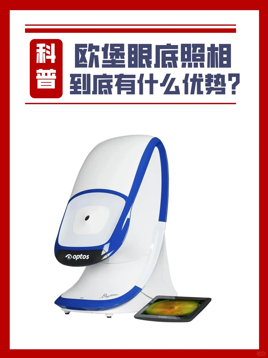 为什么眼底要定期检查？糖尿病、高度近视、高血压多久查一次？南宁人必看的眼底检查全攻略