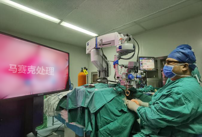 3D可视化手术平台